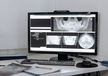 AI image upscaling technology