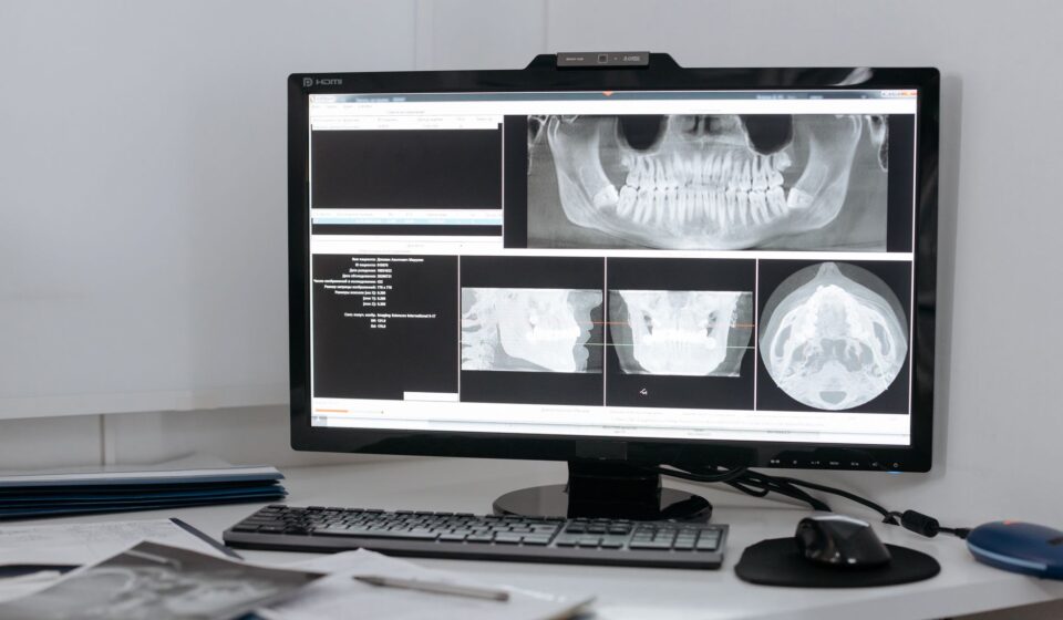 AI image upscaling technology